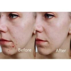 Aphrona® LED Facial Mask: Moonlight Therapy For Skin Perfection -Electronics Store aphrona led facial mask the ideal mask for your face 1 5