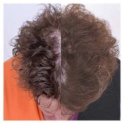 Capillus82 Laser Therapy Cap - FDA Cleared, Effective Hair Regrowth Solution -Electronics Store capillusultra mobile laser therapy cap for hair regrowth new 6 minute flexible fitting model 6