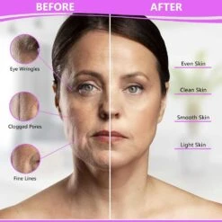 Dermal-Tech Flexible PDT LED Face Mask - Red Light Therapy For Anti-Aging, Dark Spots, And Skin Rejuvenation -Electronics Store dermal tech flexible pdt led face mask red light therapy for anti aging dark spots and skin rejuvenation 4