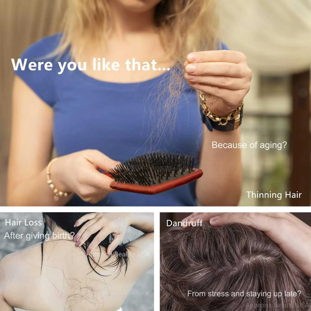 FDA-Cleared Laser Hair Regrowth Cap, Red Light Therapy Helmet For Men And Women 2 FDA-Cleared Laser Hair Regrowth Cap, Red Light Therapy Helmet For Men And Women - Image 2