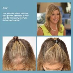 HairMax Laser Hair Growth Comb, FDA Cleared, Laser Hair Growth Treatment -Electronics Store hairmax laser hair growth comb fda cleared laser hair growth treatment 1 7