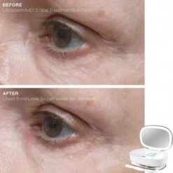 Trophy Skin UltradermMD: 3-in-1 Microdermabrasion Home Spa Kit