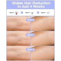 Ziska Laser Hair Removal For Men & Women Painless, Cooling IPL At Home For Smooth Skin -Electronics Store ziska laser hair removal for men women 2